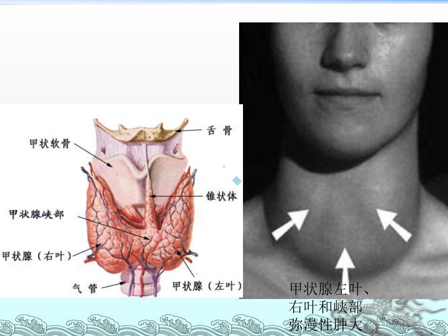 甲亢性心脏病课件-2.ppt_第2页