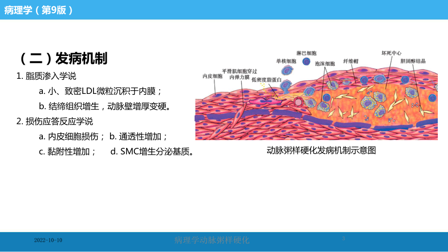 病理学动脉粥样硬化培训课件.ppt_第3页