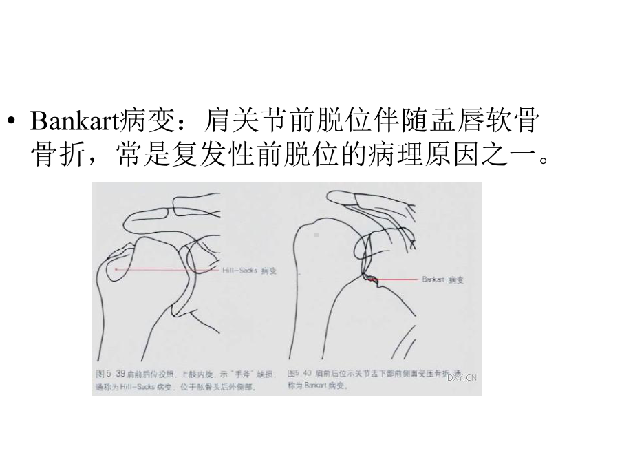 特殊名称骨折俱乐部课件.pptx_第3页