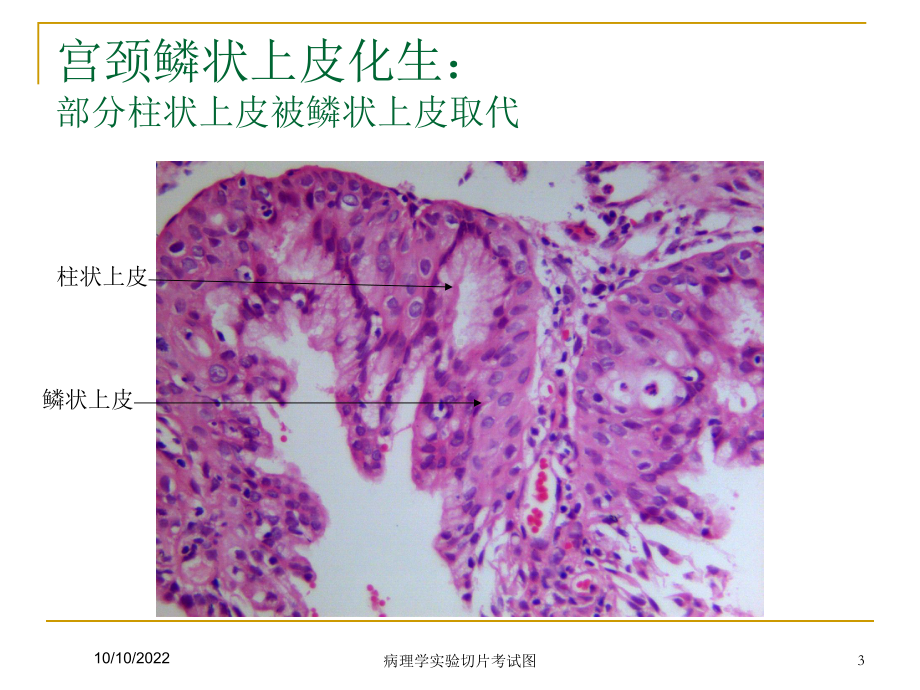 病理学实验切片考试图培训课件.ppt_第3页