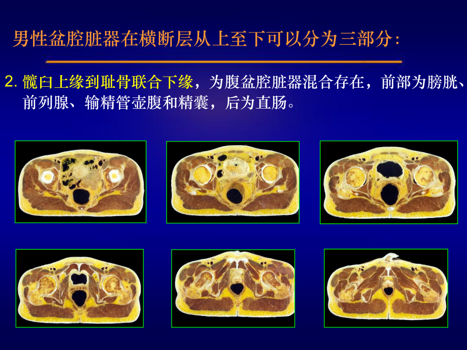 男性盆腔连续横断层解剖课件.ppt_第2页