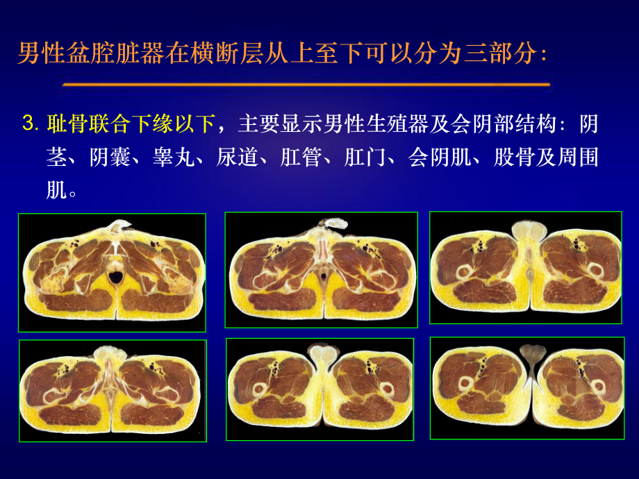 男性盆腔连续横断层解剖课件.ppt_第3页