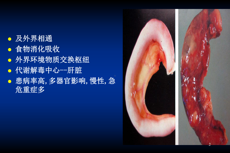 病理学消化系统疾病课件.ppt_第2页