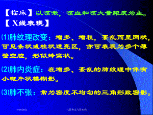 气管和支气管疾病培训课件.ppt