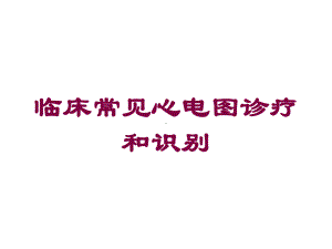 临床常见心电图诊疗和识别培训课件.ppt