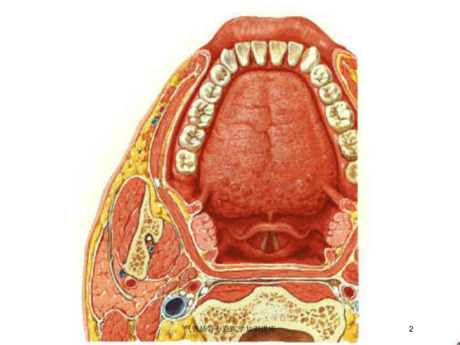 气管插管专业医学知识讲座培训课件.ppt_第2页