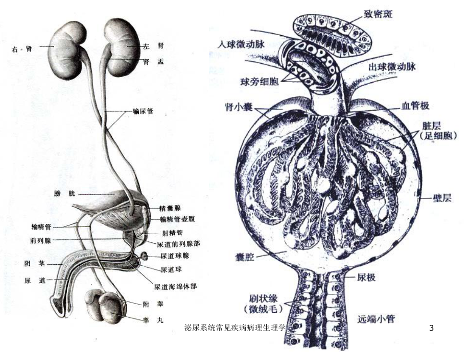 泌尿系统常见疾病病理生理学培训课件.ppt_第3页