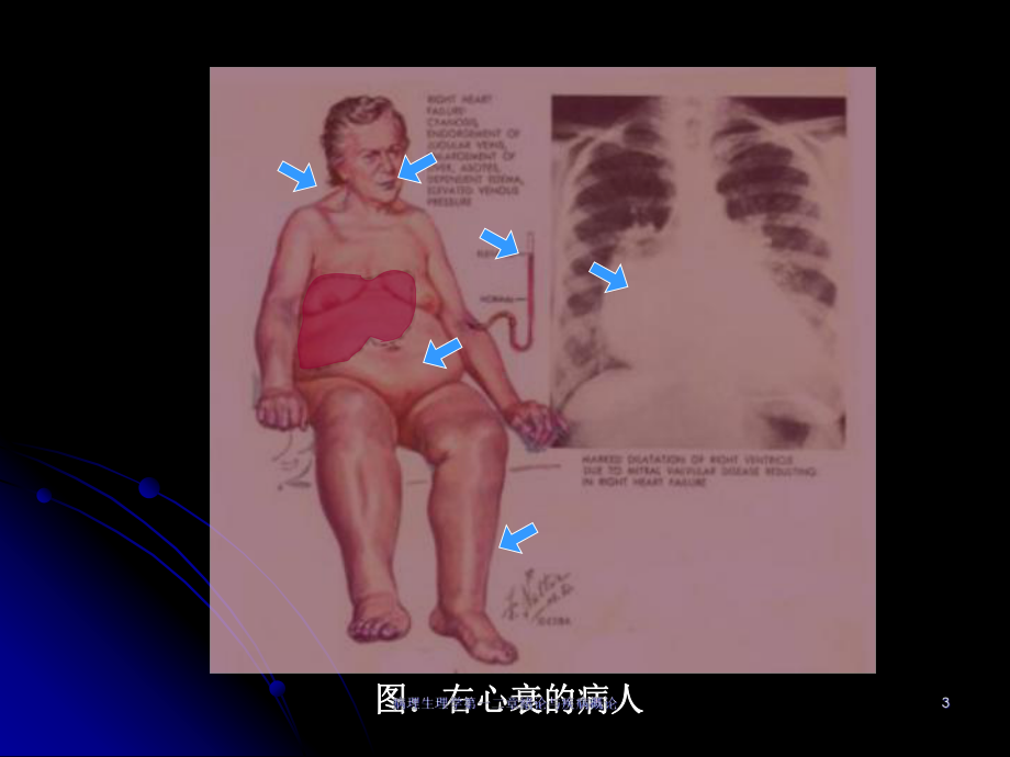 病理生理学第一二章绪论与疾病概论课件.ppt_第3页