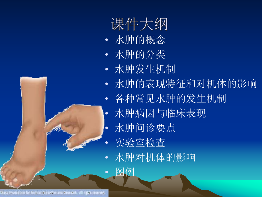 水肿的基本概述及鉴别课件.ppt_第2页