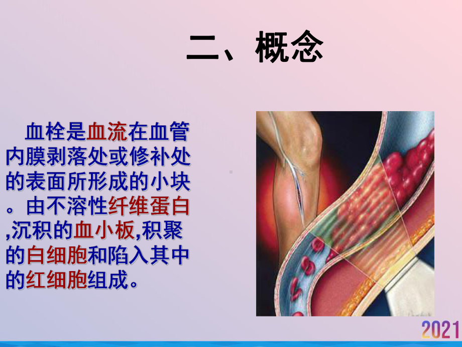 深静脉血栓的防治与护理课件.ppt_第3页