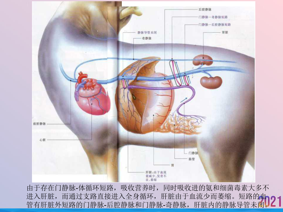 犬门脉系统血管异常课件.ppt_第3页