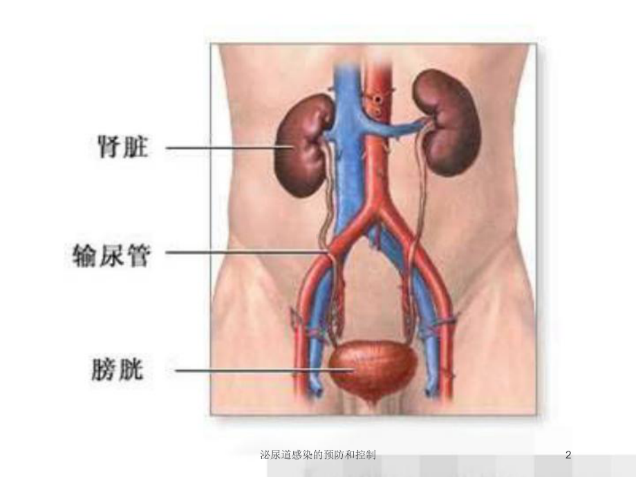 泌尿道感染的预防和控制培训课件.ppt_第2页