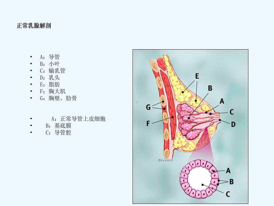 乳腺疾病超声诊断1.ppt_第3页