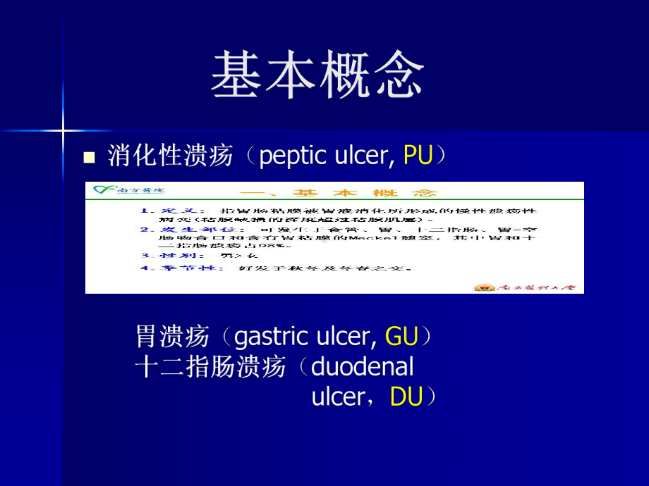 消化性溃疡内科课件.ppt_第2页