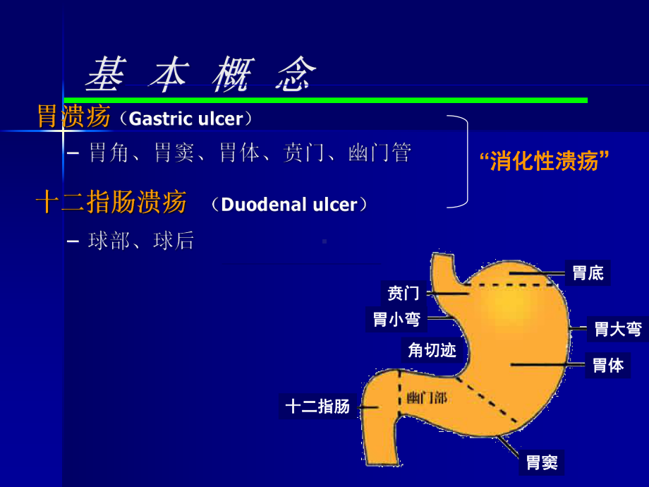 消化性溃疡内科课件.ppt_第3页