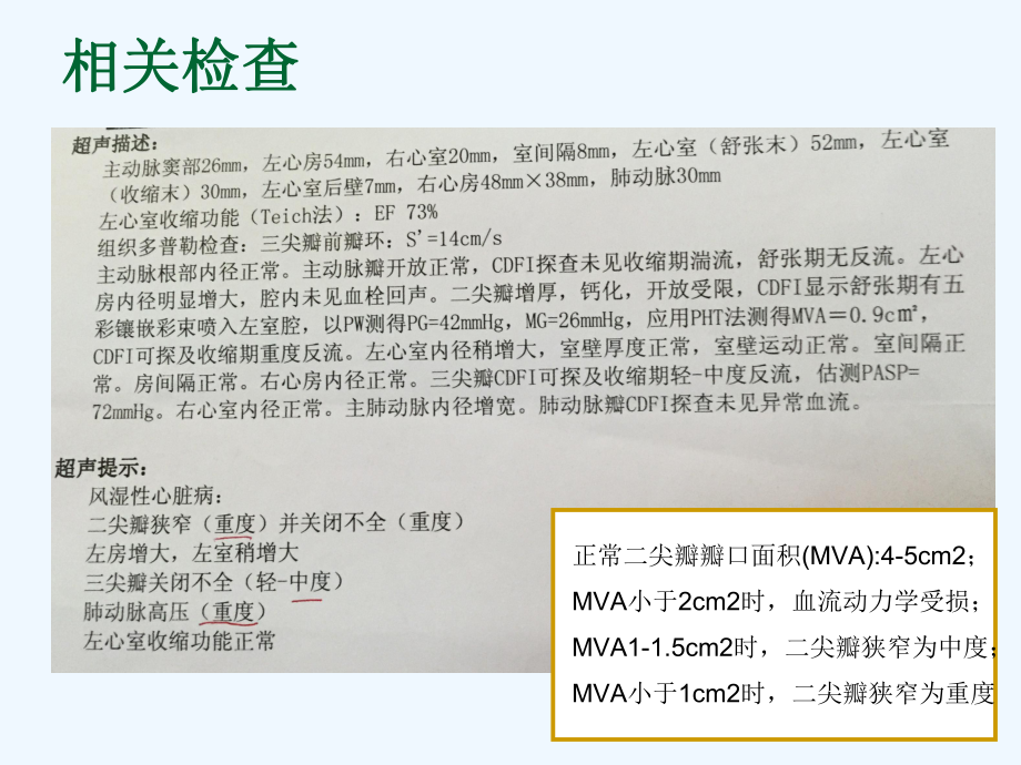 病例讨论10月二尖瓣狭窄课件.ppt_第3页