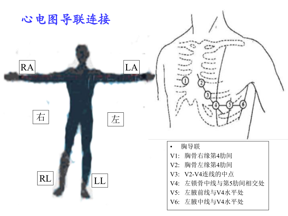 临床心电图教学.ppt_第3页