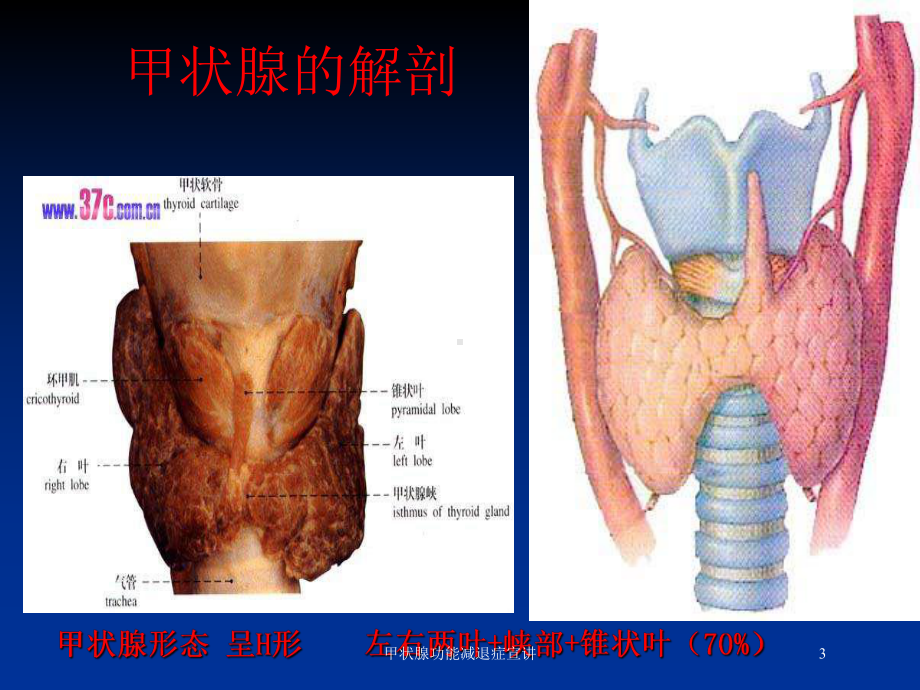 甲状腺功能减退症宣讲培训课件.ppt_第3页