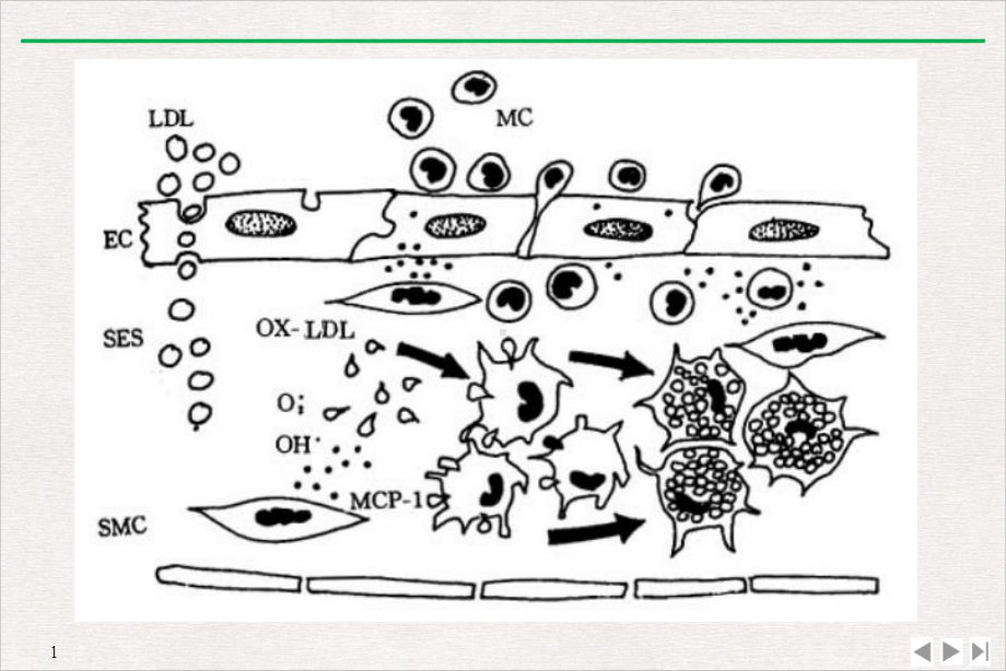 病理动脉粥样硬化实用版课件.pptx_第3页