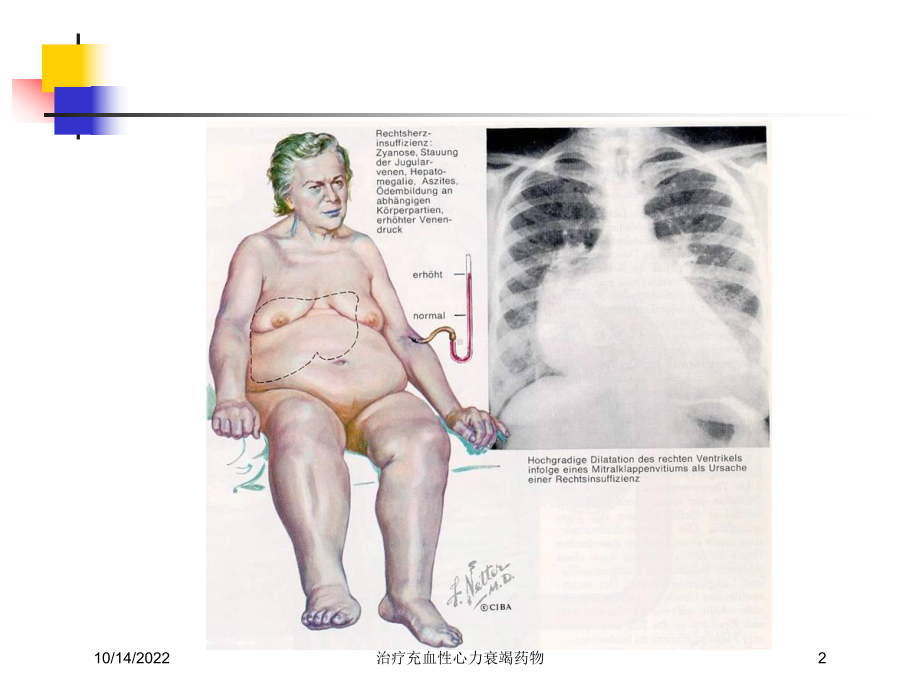 治疗充血性心力衰竭药物培训课件.ppt_第2页