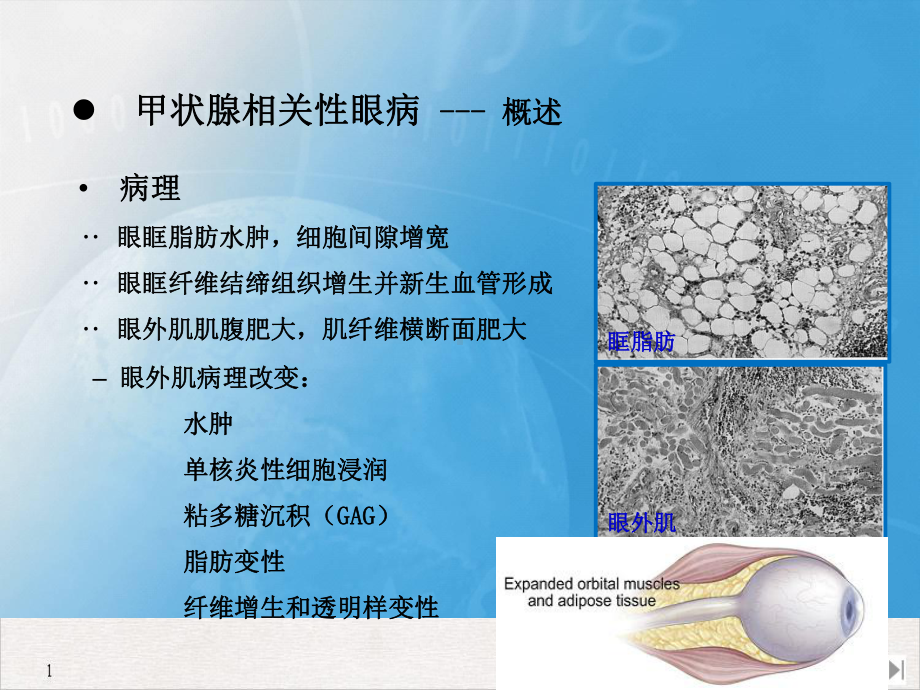 甲状腺相关性眼病影像学表现精选课件.pptx_第2页