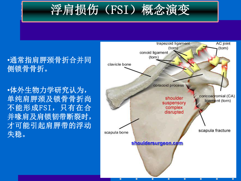 浮肩损伤课件.ppt_第3页