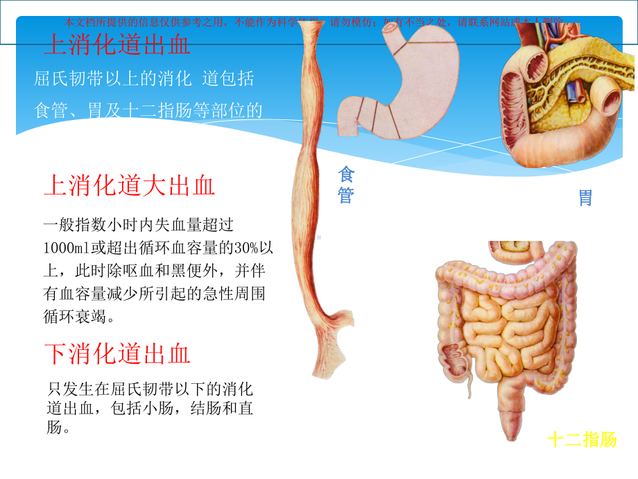 消化道出血护理培训课件.ppt_第3页