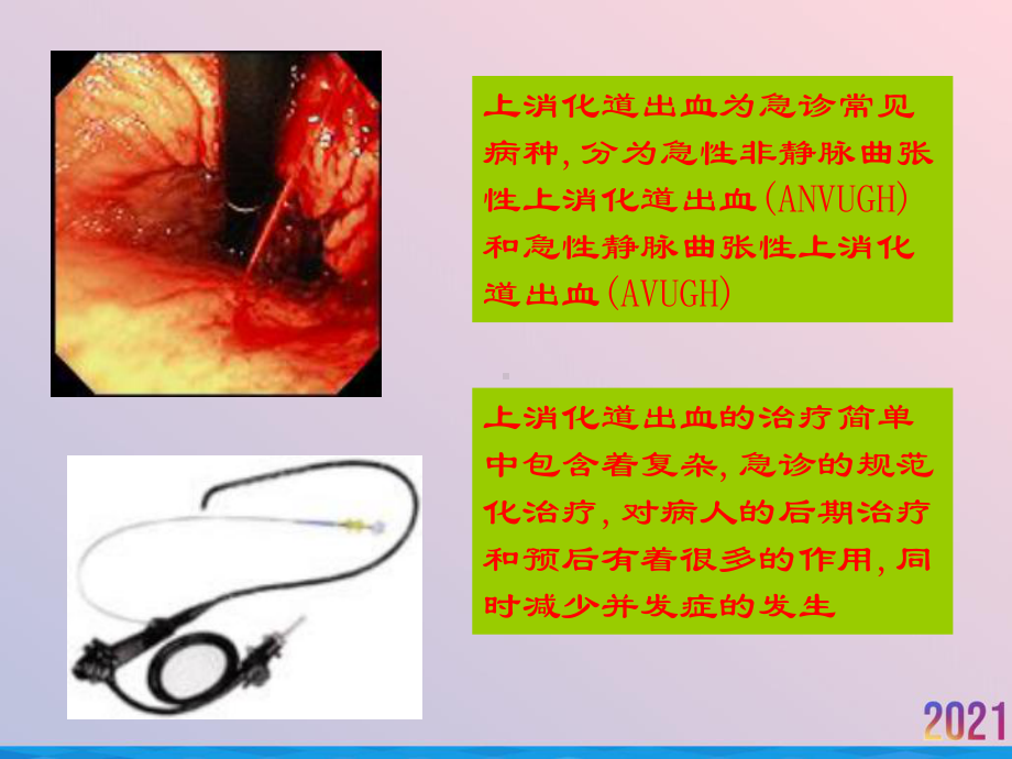 病案讨论急性上消化道出血课件-2.ppt_第2页