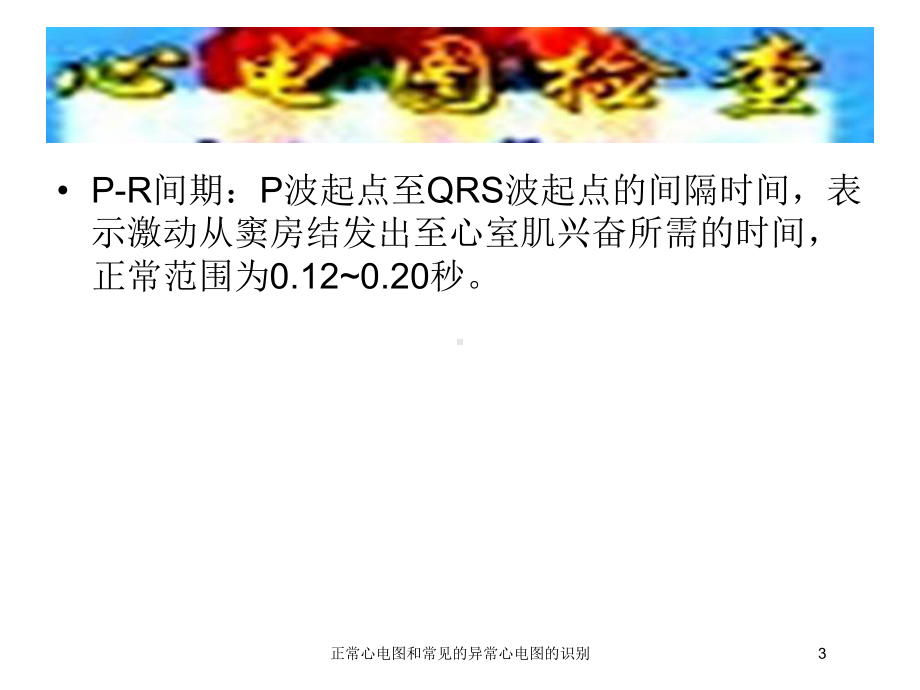 正常心电图和常见的异常心电图的识别培训课件.ppt_第3页