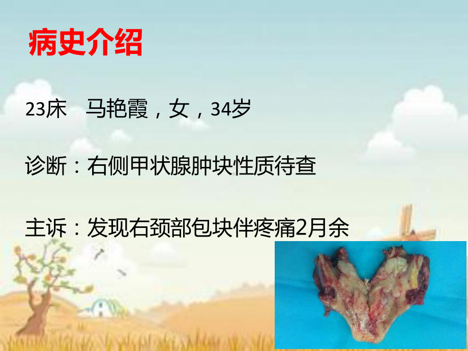 甲状腺医疗护理查房讲解培训课件-2.ppt_第2页