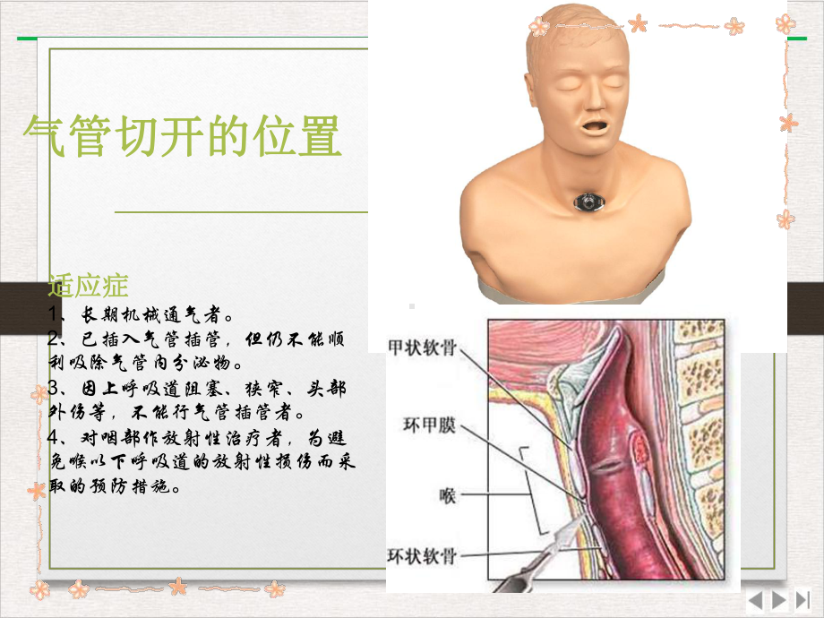 气切护理优选课件.pptx_第3页