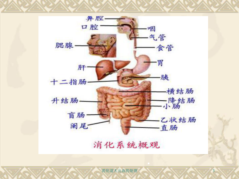 消化道大出血的处理培训课件.ppt_第3页