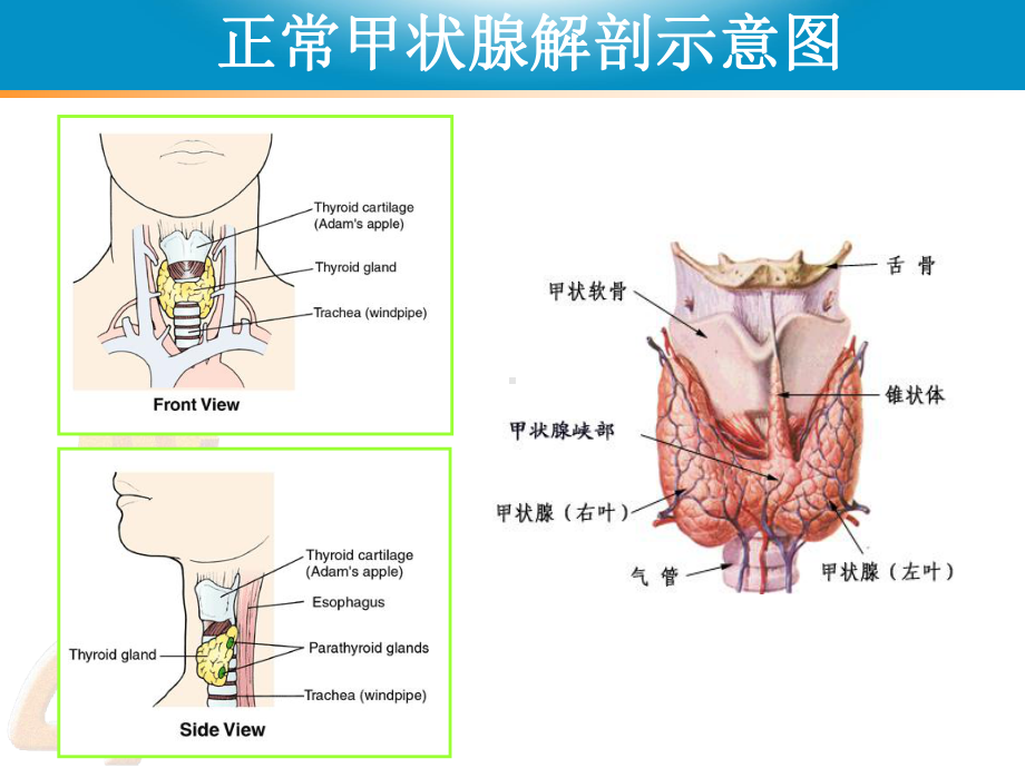 甲状腺功能亢进症甲亢讲义课件.ppt_第3页