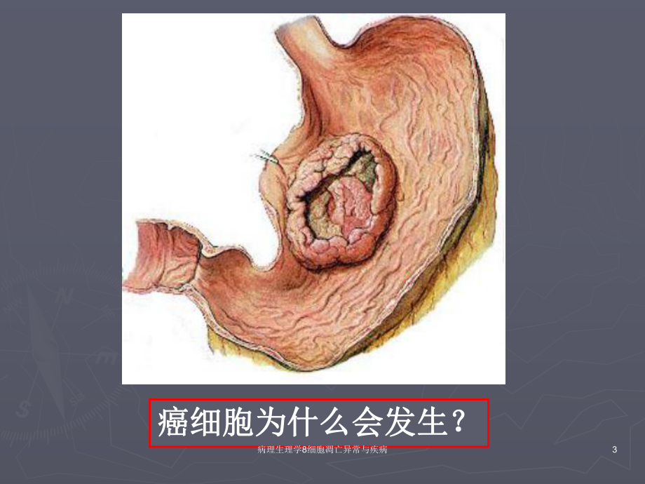 病理生理学8细胞凋亡异常与疾病课件.ppt_第3页