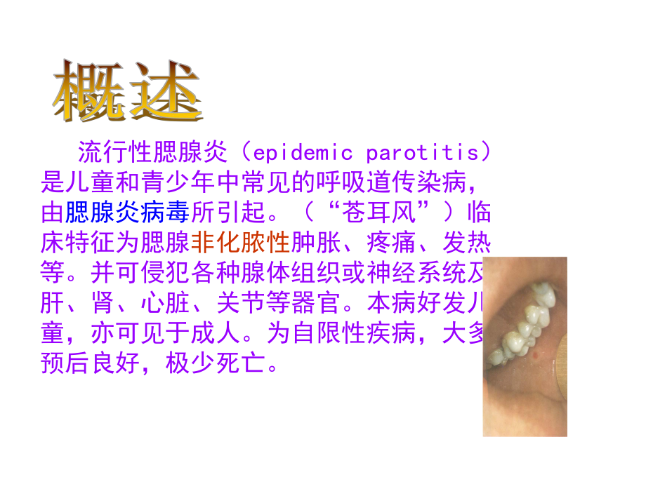 流行性腮腺炎防治知识课件.ppt_第2页