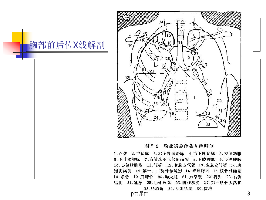 正常胸片胸部CT阅读浅谈-课件.ppt_第3页