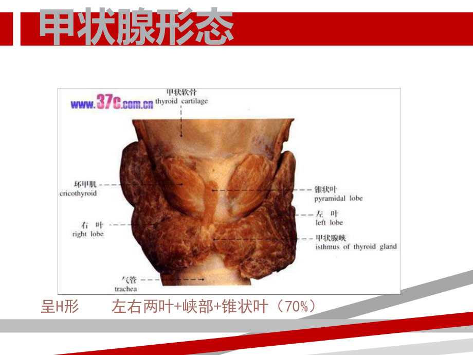 甲状腺肿瘤的护理课件.ppt_第3页