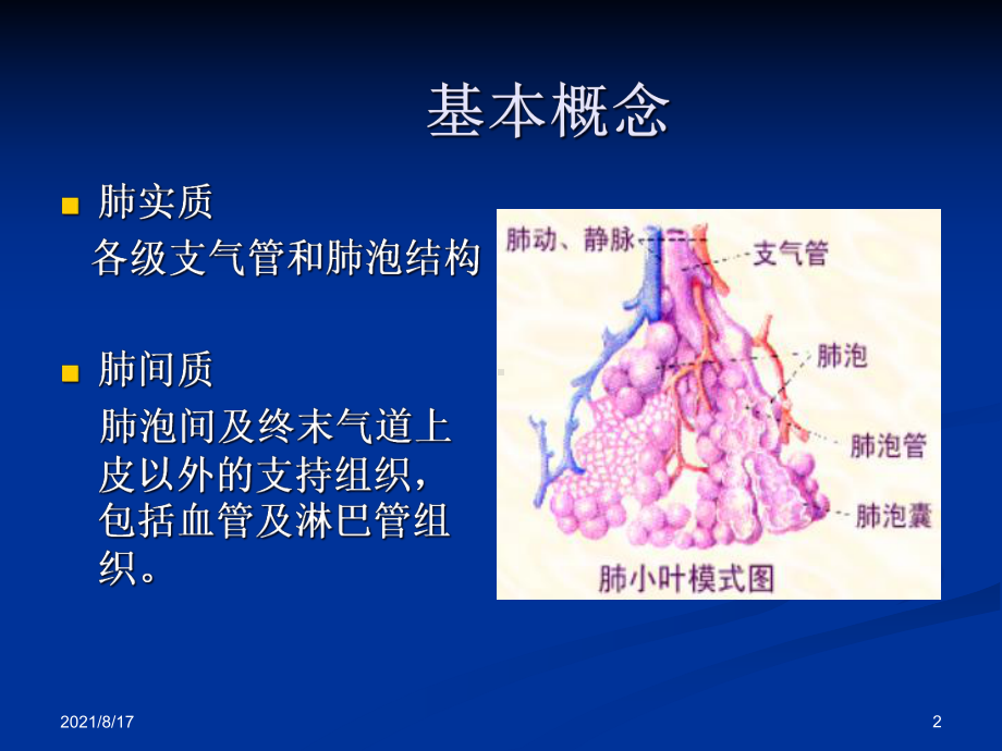 特发性肺纤维化-课件2.ppt_第2页