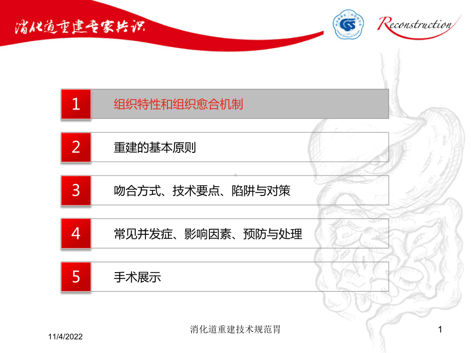 消化道重建技术规范胃培训课件.ppt_第1页