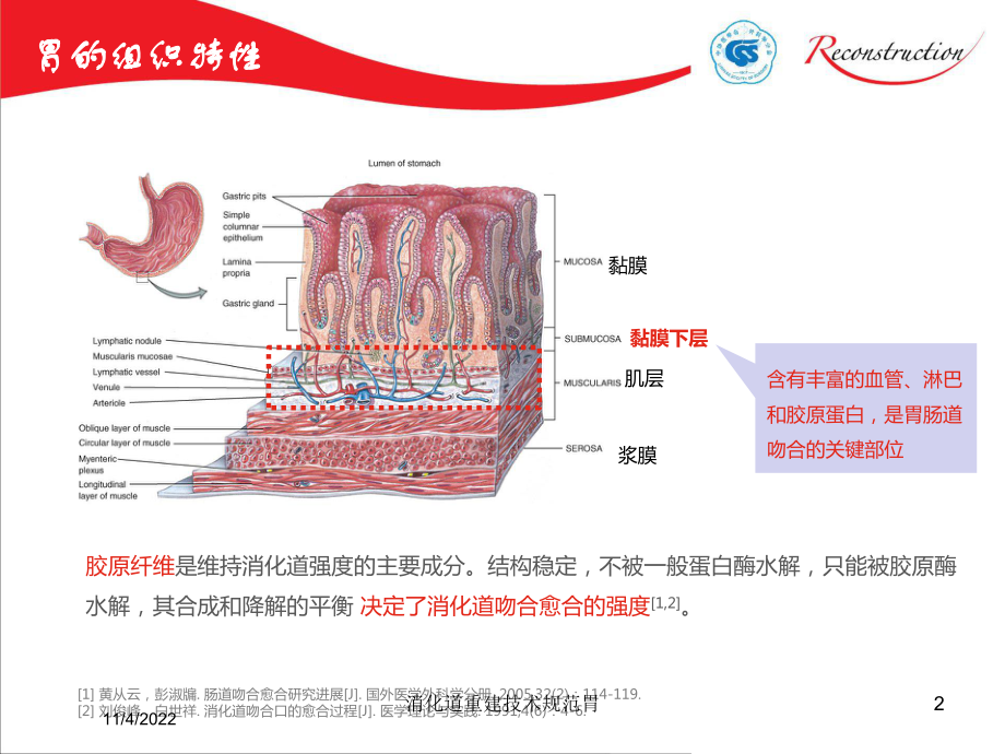 消化道重建技术规范胃培训课件.ppt_第2页