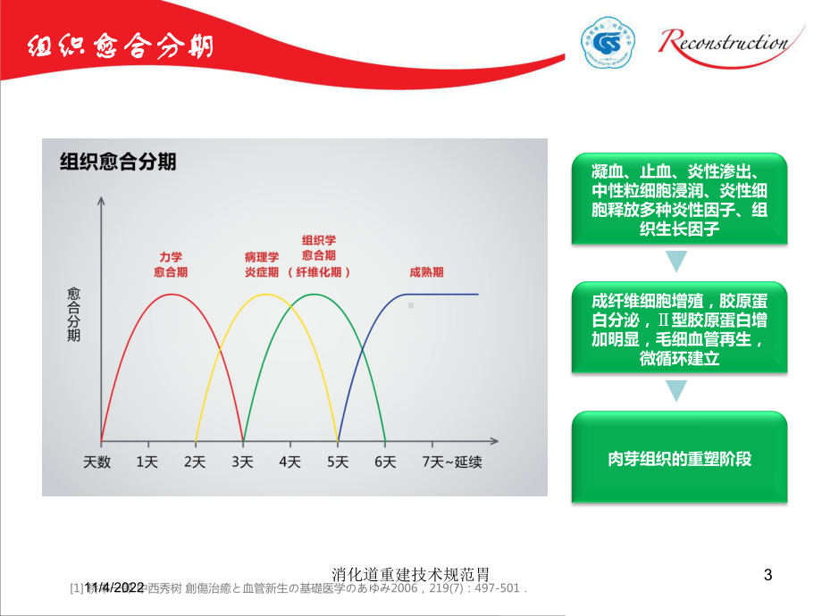 消化道重建技术规范胃培训课件.ppt_第3页