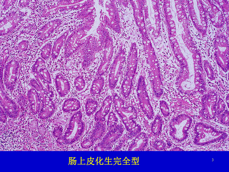 病理学实习镜下消化系统课件.ppt_第3页