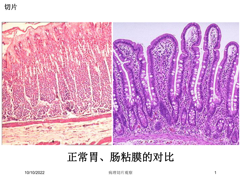 病理切片观察培训课件.ppt_第1页