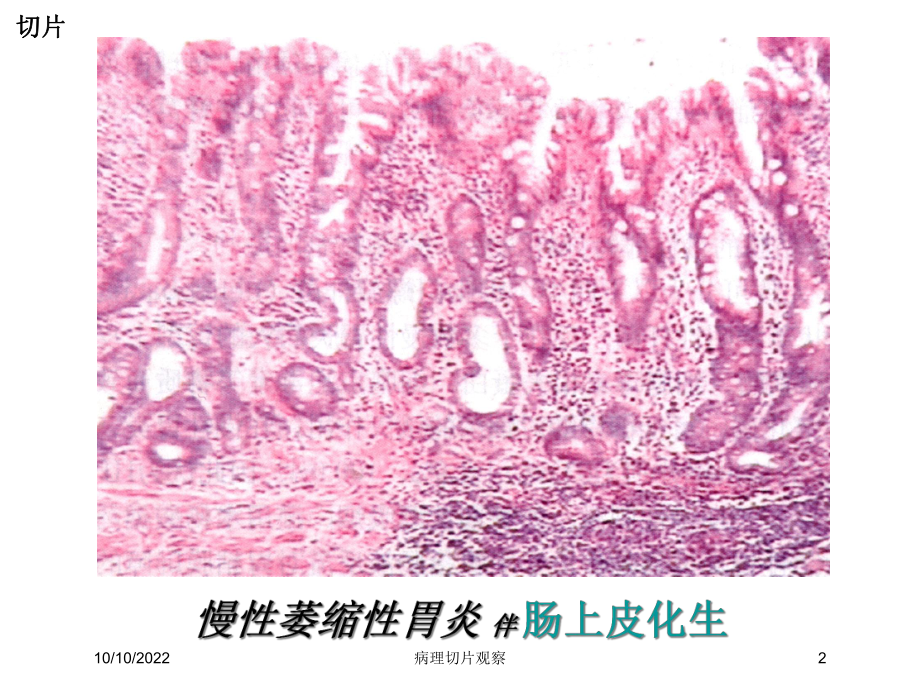 病理切片观察培训课件.ppt_第2页