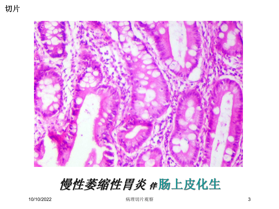 病理切片观察培训课件.ppt_第3页