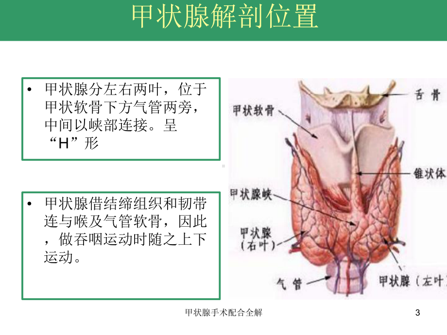 甲状腺手术配合全解培训课件.ppt_第3页