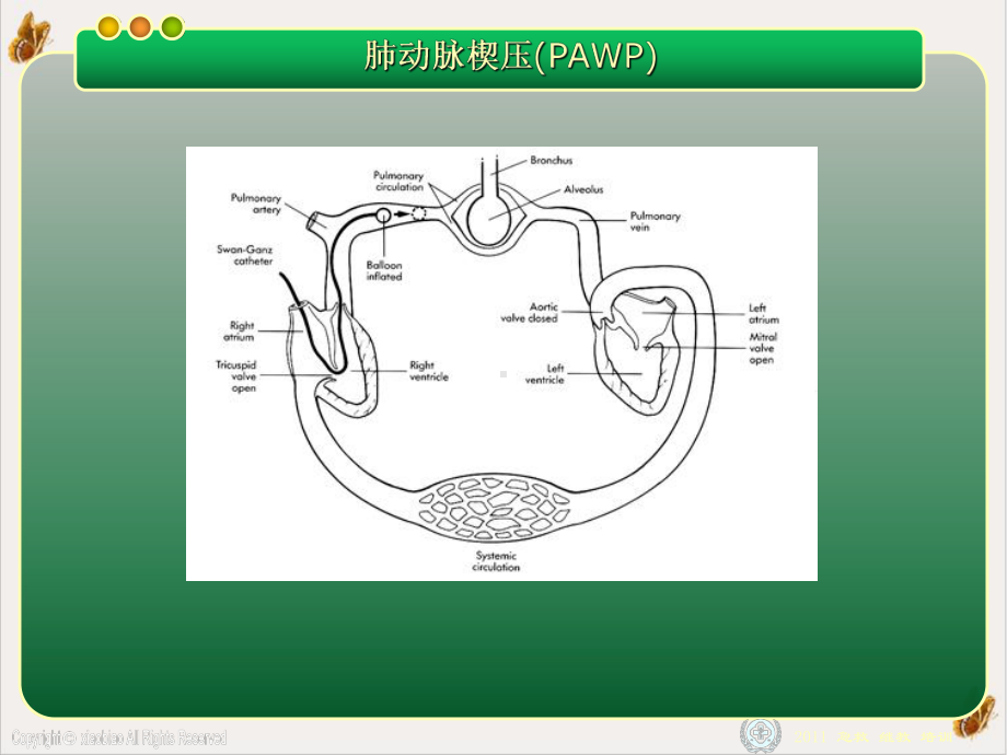 漂浮导管临床应用进展[1]培训课程课件.pptx_第1页