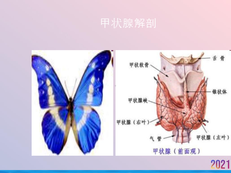 甲状腺癌根治术中喉返神经监测技术的应用课件-2.ppt_第2页