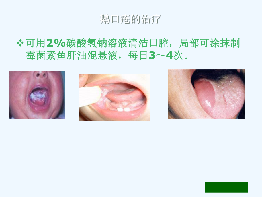 消化系统疾病剖析课件.ppt_第3页