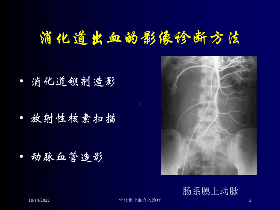 消化道出血介入治疗培训课件.ppt_第2页